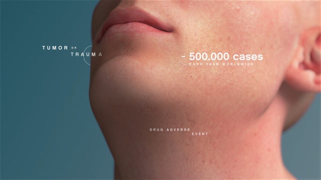 Novadip - NVD 001 - 3D