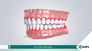 Campaña PERIOKIN - 3D