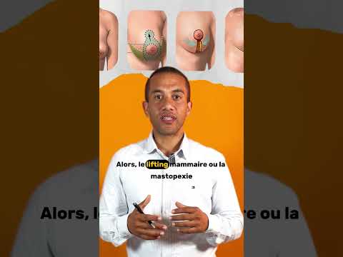 Stratégie et création de vidéos pour chirurgien esthétique - Content Strategy