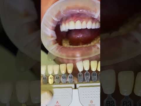 I Smile - Social Media