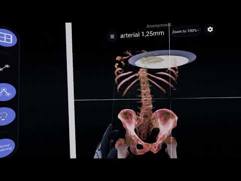 VR Medical App for Visualizing CT and MRI Scans - Software Development