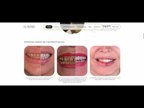 Dental Clinic: Multilingual Site & Automated AI Blog - Aplicación Web