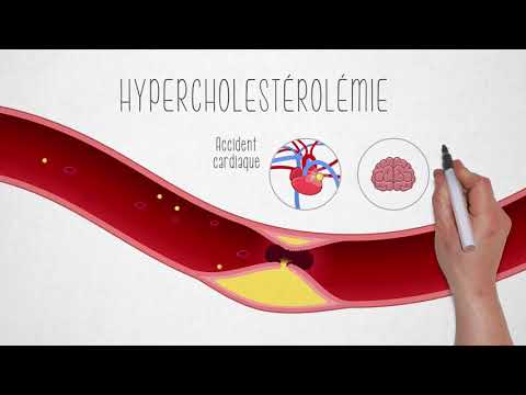 Cholesterol awareness video - Videoproduktion