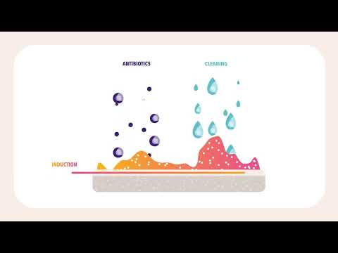 NLC Health | Implant Preservation Devices - Videoproduktion